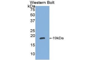 Western blot analysis of the recombinant protein. (alpha 2 Antiplasmin Antikörper  (AA 348-491))