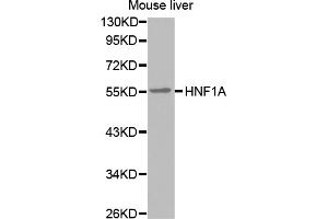 Western blot analysis of extracts of mouse liver, using HNF1A antibody (ABIN5971580). (HNF1A Antikörper)