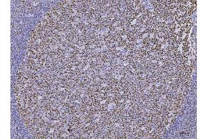 IHC analysis of MSH2 using anti-MSH2 antibody (ABIN7601369). (MSH2 Antikörper  (AA 337-583))