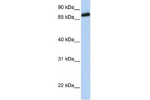 LRCH4 antibody used at 1 ug/ml to detect target protein. (LRCH4 Antikörper)