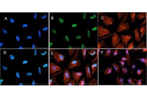 Fluorescence Microscopy (FM) image for anti-Histone 3 (H3) (H3K14ac), (H3K9ac) antibody (ABIN5706782)