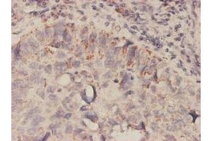 Image no. 1 for anti-Macrophage Migration Inhibitory Factor (Glycosylation-Inhibiting Factor) (MIF) (AA 1-116) antibody (ABIN466058) (MIF Antikörper  (AA 1-116))