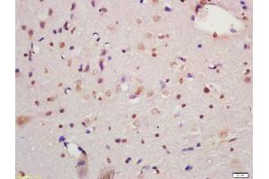 Formalin-fixed and paraffin embedded rat brain labeled with Anti-MAPK organizer 1 Polyclonal Antibody, Unconjugated (ABIN720475) at 1:200 followed by conjugation to the secondary antibody and DAB staining (MORG1 Antikörper  (AA 201-315))