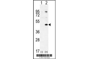 Western blot analysis of TGIF1 using rabbit polyclonal using 293 cell lysates (2 ug/lane) either nontransfected (Lane 1) or transiently transfected (Lane 2) with the TGIF1 gene. (TGIF1 Antikörper  (AA 208-237))