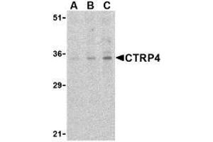 Western blot analysis of CTRP4 in rat brain cell lysate with AP30252PU-N CTRP4 antibody at (A) 1, (B) 2, and (C) 4 μg/ml. (C1QTNF4 Antikörper  (C-Term))