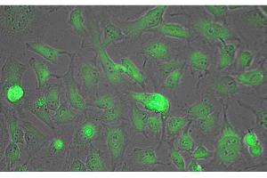 Immunofluorescence Microscopy of Biotin conjugated Anti-Lactate Dehydrogenase Antibody. (Lactate Dehydrogenase Antikörper)