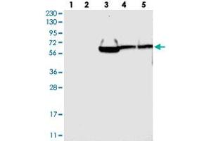 Western blot analysis of Lane 1: RT-4, Lane 2: U-251 MG, Lane 3: Human Plasma, Lane 4: Liver, Lane 5: Tonsil with GRAMD1A polyclonal antibody . (GRAMD1A Antikörper)
