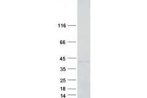 Western Blotting (WB) image for Lectin, Galactoside-Binding, Soluble, 9 (LGALS9) (Transcript Variant 1) protein (Myc-DYKDDDDK Tag) (ABIN2721658)