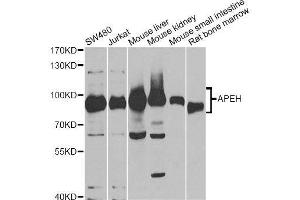 Western blot analysis of extracts of various cell lines, using APEH antibody. (APEH Antikörper  (AA 1-260))