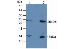 Figure. (CXCL7 Antikörper  (AA 59-128))