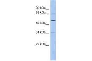 Image no. 1 for anti-Zinc Finger Protein 641 (ZNF641) (AA 179-228) antibody (ABIN6742656) (ZNF641 Antikörper  (AA 179-228))