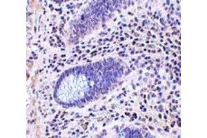 Immunohistochemistry (IHC) image for anti-Leucine Rich Repeat Containing 1 (LRRC1) (C-Term) antibody (ABIN1030477) (LRRC1 Antikörper  (C-Term))