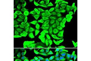Immunofluorescence analysis of MCF-7 cells using DCD Polyclonal Antibody (Dermcidin Antikörper)