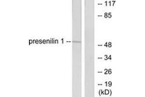 Western Blotting (WB) image for anti-Presenilin 1 (PSEN1) (AA 1-50) antibody (ABIN2889251) (Presenilin 1 Antikörper  (AA 1-50))