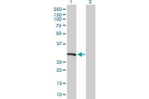 Western Blot analysis of HLA-DRB5 expression in transfected 293T cell line by HLA-DRB5 MaxPab polyclonal antibody. (HLA-DRB5 Antikörper  (AA 1-266))