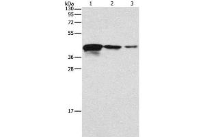 Western Blot analysis of Human endometrial carcinoma tissue, A172 and U937 cell using TWF2 Polyclonal Antibody at dilution of 1:800 (TWF2 Antikörper)