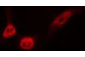 ABIN6276751 staining HeLa cells by IF/ICC. (ETS1 Antikörper  (Internal Region))