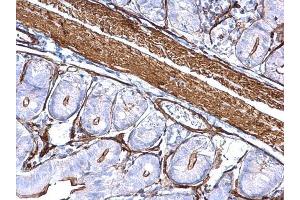 IHC-P Image alpha Cardiac Muscle Actin antibody detects alpha Cardiac Muscle Actin protein at cytoplasm on mouse small intestine by immunohistochemical analysis. (ACTC1 Antikörper)