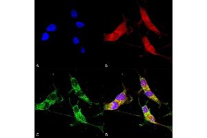 Immunocytochemistry/Immunofluorescence analysis using Mouse Anti-VGLUT2 Monoclonal Antibody, Clone S29-29 (ABIN2483742).