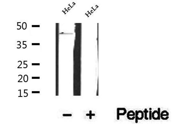 FBXO22 Antikörper  (Internal Region)