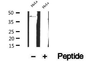 Western blot analysis of extracts of HeLa cells, using FBXO22 antibody. (FBXO22 Antikörper  (Internal Region))