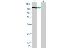 Western Blot analysis of PTPN22 expression in transfected 293T cell line by PTPN22 monoclonal antibody (M01), clone 4F6. (PTPN22 Antikörper  (AA 1-179))