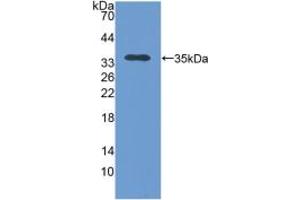 Western blot analysis of recombinant Human TOMM70A. (TOM70 Antikörper  (AA 333-608))
