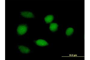 Immunofluorescence of purified MaxPab antibody to BLVRA on HeLa cell. (Biliverdin Reductase Antikörper  (AA 1-296))