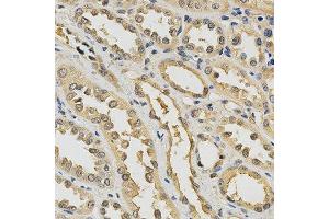 Immunohistochemistry of paraffin-embedded human kidney using PDGFRB antibody at dilution of 1:200 (x400 lens) (PDGFRB Antikörper  (AA 887-1106))