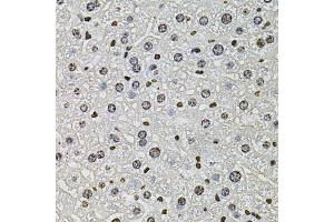 Immunohistochemistry of paraffin-embedded mouse liver using H2AFZ antibody (ABIN5973977) at dilution of 1/100 (40x lens). (H2AFZ Antikörper)