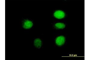 Immunofluorescence of purified MaxPab antibody to ARNT on HeLa cell. (ARNT Antikörper  (AA 1-789))