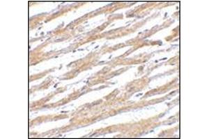Immunohistochemistry of PDL-1 in human heart tissue with this product at 2. (PD-L1 Antikörper  (Center))