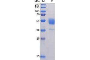 Human CD37 Protein, hFc Tag on SDS-PAGE under reducing condition.