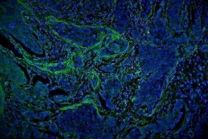 IF analysis of VCL using anti-VCL antibody (ABIN7599003).
