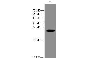 Western Blot analysis of Hela cell using IMP3 Polyclonal Antibody at dilution of 1:1000 (IMP3 Antikörper)