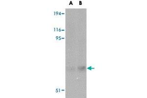 Western blot analysis of MATN2 in human liver tissue lysate with MATN2 polyclonal antibody  at (A) 1 and (B) 2 ug/mL . (MATN2 Antikörper  (C-Term))