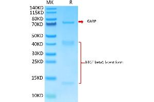 Biotinylated Human GARP&Latent TGF beta Complex on Tris-Bis PAGE under reduced condition.