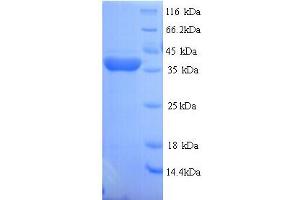 SDS-PAGE (SDS) image for Regucalcin (RGN) (AA 1-299), (full length) protein (His tag) (ABIN4975023)