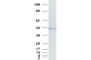 Validation with Western Blot (SIRT6 Protein (Myc-DYKDDDDK Tag))