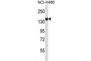 Western Blotting (WB) image for anti-Toll-Like Receptor 8 (TLR8) antibody (ABIN2997670) (TLR8 Antikörper)