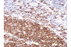 Immunohistochemistry (IHC) image for anti-Membrane-Spanning 4-Domains, Subfamily A, Member 1 (MS4A1) (C-Term) antibody (ABIN570905)