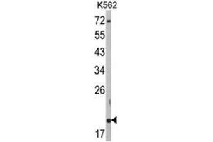 Western blot analysis of RNF5 Antibody (N-term) in K562 cell line lysates (35ug/lane). (RNF5 Antikörper  (N-Term))