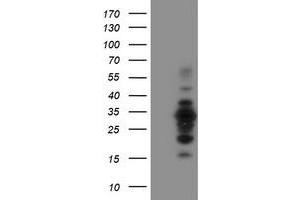 Image no. 4 for anti-MIF4G Domain Containing (MIF4GD) antibody (ABIN1499471) (MIF4GD Antikörper)