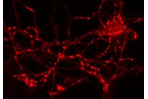 Immunolabeling of cultured hippocampus neurons (dilution 1 : 2000). (GAD65 Antikörper  (AA 3-96))