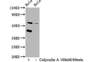 Western Blot Positive WB detected in Hela whole cell lysate(treated with Calyculin A or not) All lanes Phospho-EIF2AK2 antibody at 1. (Rekombinanter EIF2AK2 Antikörper  (pThr446))