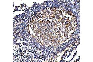IHC analysis of VCAM1 using anti-VCAM1 antibody (ABIN5692810).