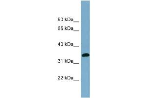 WB Suggested Anti-AWAT1 Antibody Titration:  0. (AWAT1 Antikörper  (N-Term))