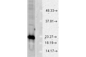 CuZn SOD Human Cell line mix 10ug WB 1 in 1000 WB. (SOD1 Antikörper)