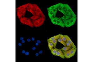 ABIN7095709 and ABIN7099771 staining Hela cells by IF/ICC.