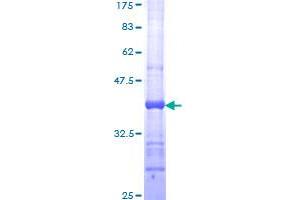 Image no. 1 for Bone Morphogenetic Protein 2 (BMP2) (AA 283-396) protein (GST tag) (ABIN1346752)